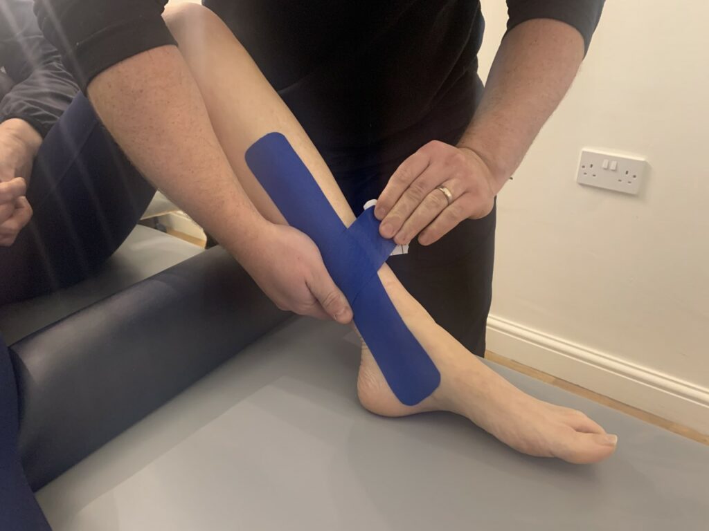 KT Tape: Posterior Shin Splints 